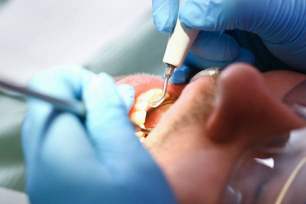 Best Emergency Treatment for Jaw Pain or Injury in Emeryville, CA